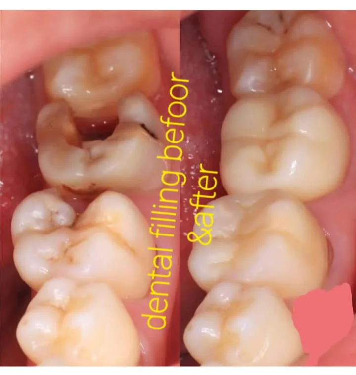 Alanya HEALTHY TEETH Dental Aesthetic — Léky v Alanyi: Online objednávka, ceny a recenze